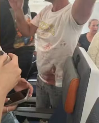‘Sangue por toda parte’: passageiros relatam horror em voo para Israel após piloto ser esfaqueado
