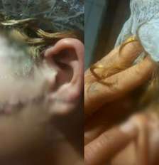 Suspeito teria desfigurado rosto da ex-esposa ao golpeá-la com uma faca Foto: Reprodução/TV Anhanguera