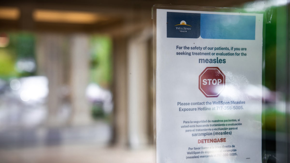 Nova York declara emergência por sarampo após registrar mais de 100 casos